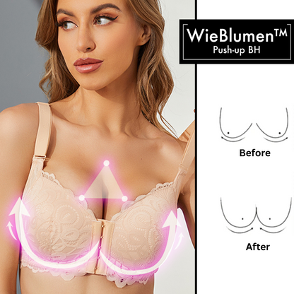 Front-Closure Push-Up Bra with Removable Straps